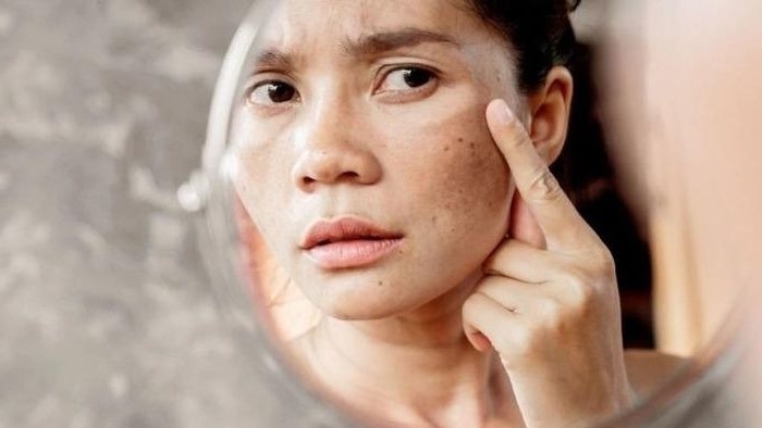 Lão hóa cơ học: Giải pháp thư giãn cơ ngăn nếp nhăn biểu cảm
