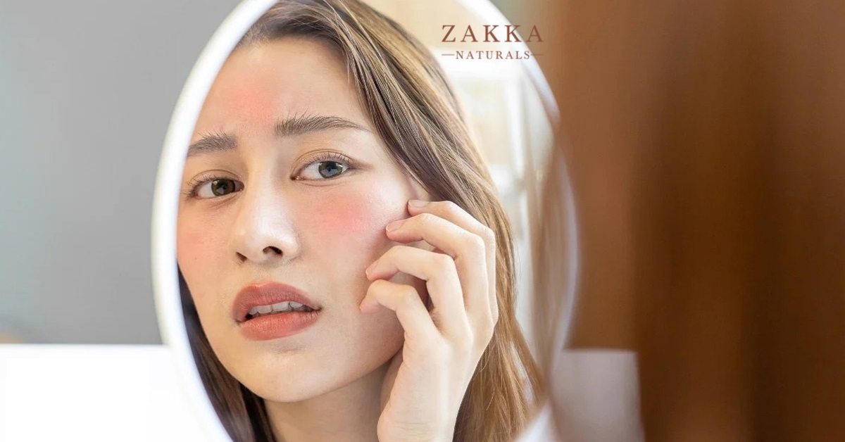 Niacinamide và da nhạy cảm: Hiểu về độ tinh khiết