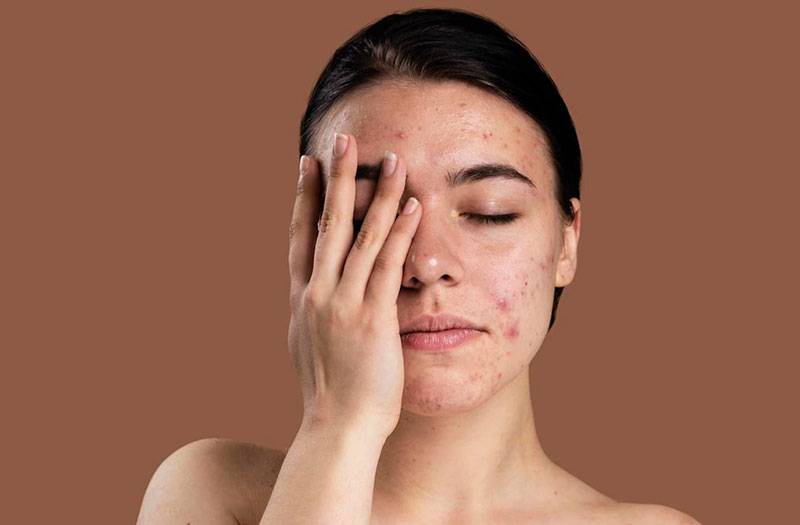 DA NHẠY CẢM – DƯỠNG SÁNG: Phục hồi an toàn từ gốc