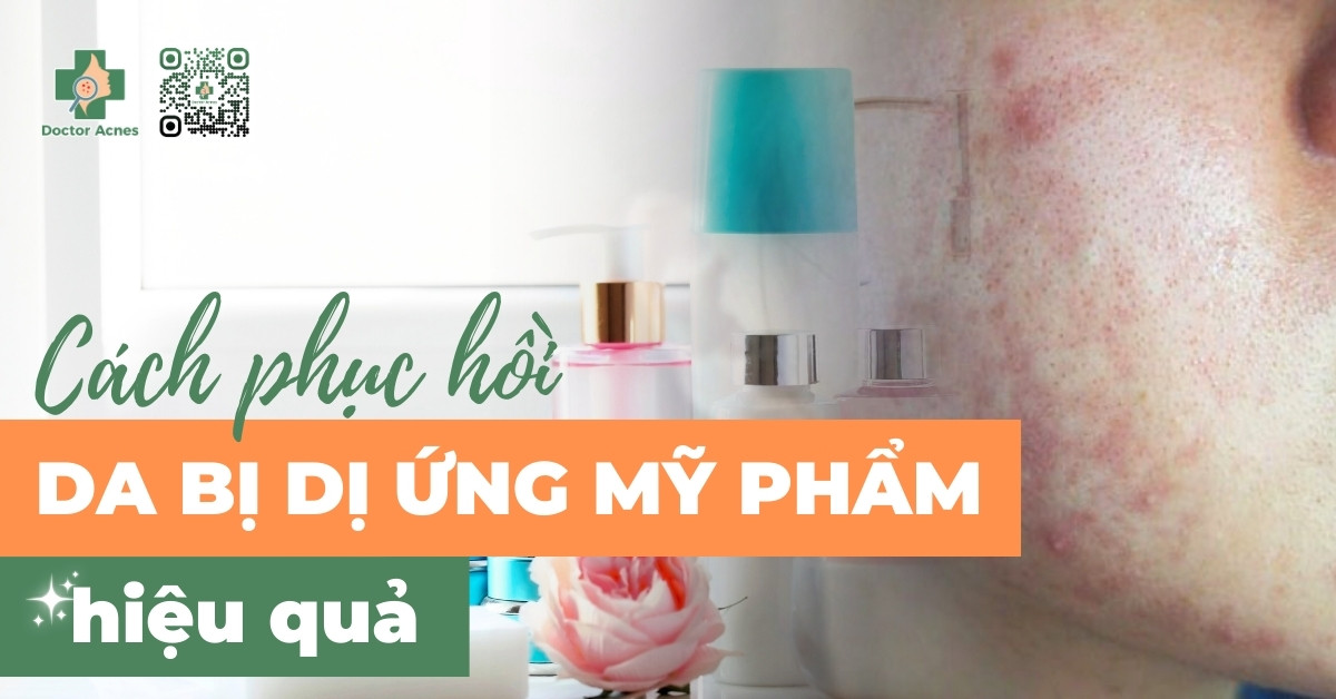 DA NHẠY CẢM – DƯỠNG SÁNG: 7 Dấu Hiệu Kích Ứng Cần Lưu Ý