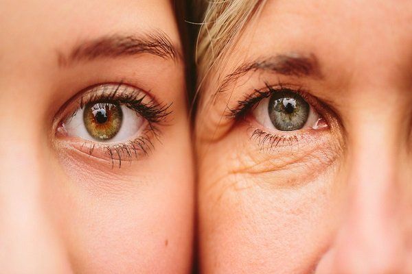 Công nghệ nâng cơ mắt: Giải pháp xóa nhăn tĩnh chuyên sâu