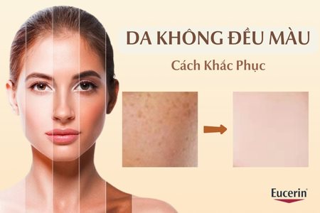 Serum tiền triệu vẫn khô sạm? Đông y phục hồi da từ gốc