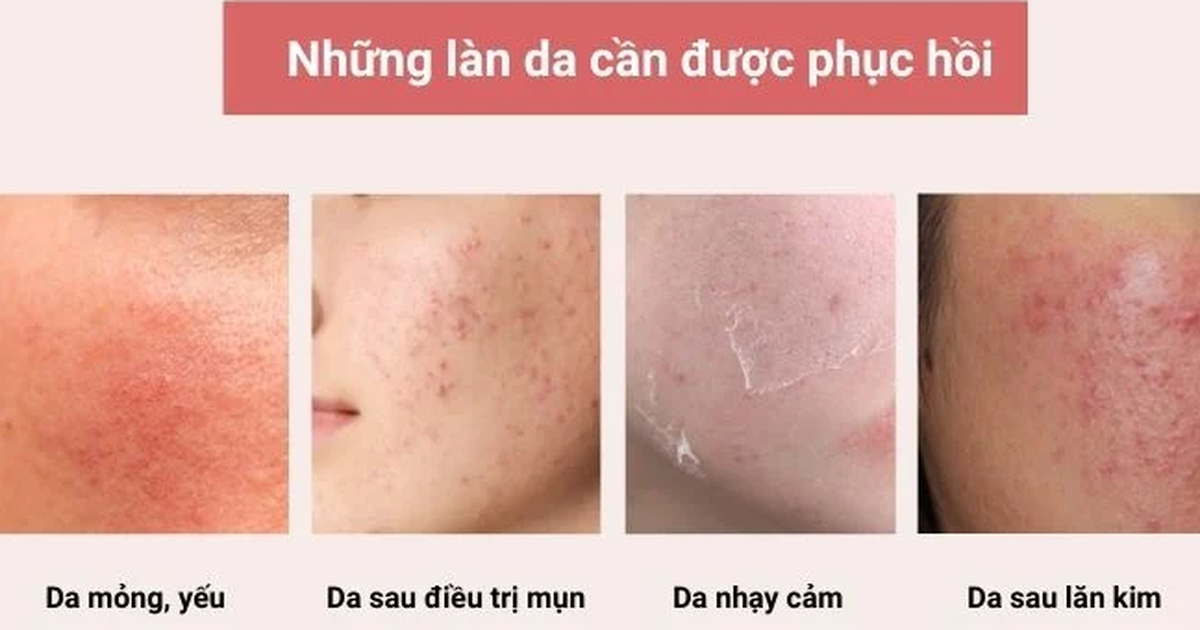 Dưỡng da khoa học: Khi nào da thực sự phục hồi?