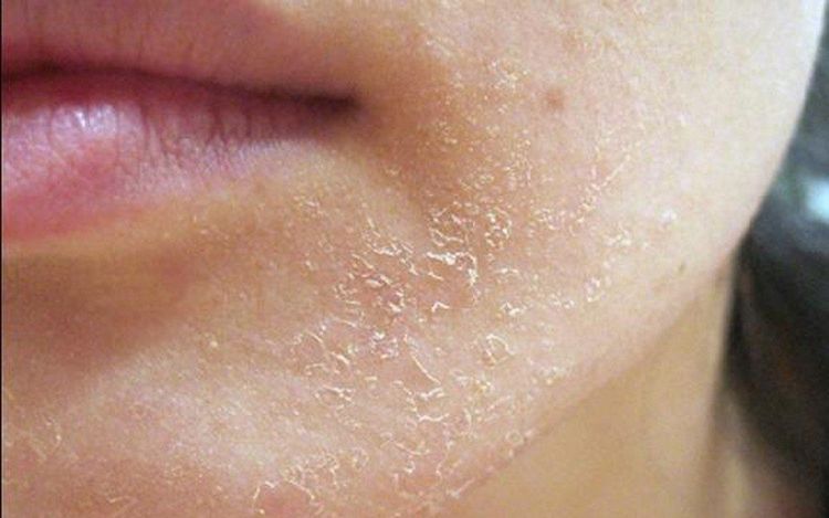Lão hóa nội tiết: Giải pháp GIẢM NHĂN – NÂNG CƠ chuyên biệt
