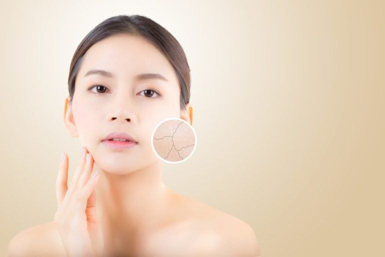 Giảm nhăn – Nâng cơ: Căn nguyên thật sự khiến da chảy xệ