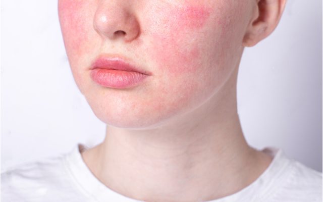 DA SAU TREATMENT: CẨM NANG PHỤC HỒI CHUYÊN SÂU