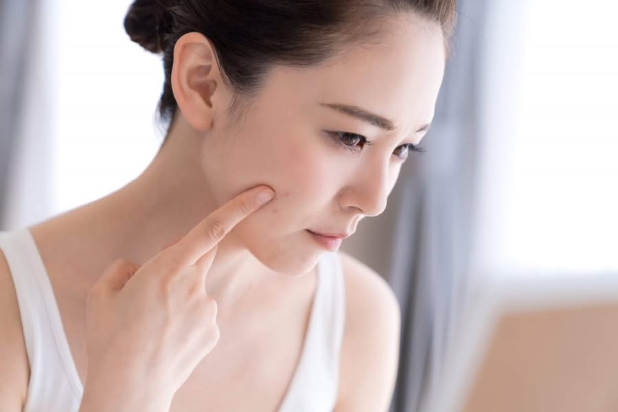 Đông y và Dưỡng sinh: Bí quyết dưỡng da khi bị stress