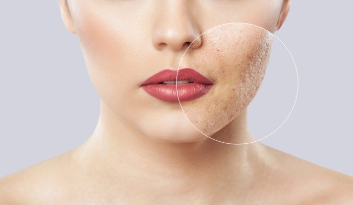 Da xỉn màu do trệ khí: Bí quyết đả thông năng lượng