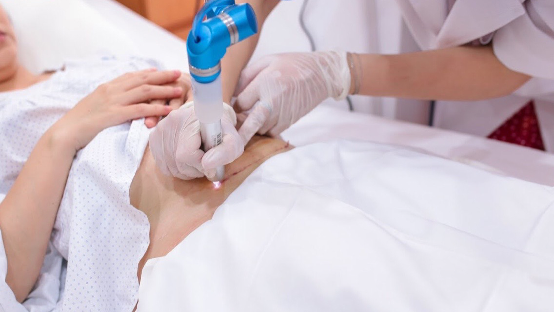 Chăm Sóc DA SAU TREATMENT: Hướng Dẫn Khoa Học Phục Hồi