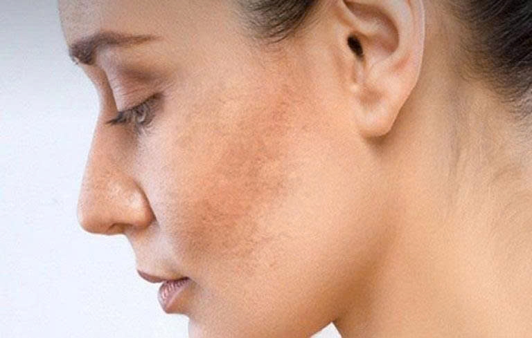 Đông Y Dưỡng Sinh: Phục Hồi Làn Da Từ Lối Sống Hiện Đại