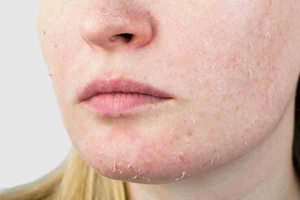 DA SAU TREATMENT: Nghệ thuật phục hồi khoa học