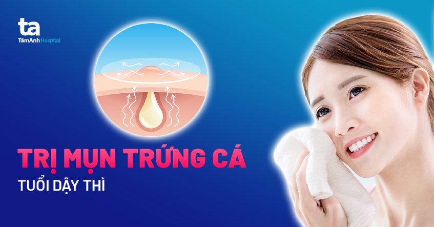 Da mụn và cách xử lý vào mùa nóng: Bí kíp khoa học