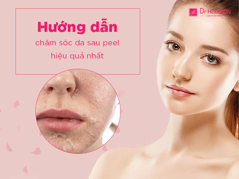 Chăm sóc DA SAU TREATMENT: Sai lầm làm chậm phục hồi